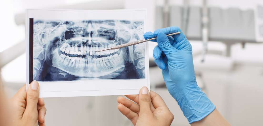 Dentist showing X-ray image to patient. People, medicine, stomatology, technology and health care concept - happy female dentist with teeth x-ray image and patient woman at dental clinic office. No face, only hands close-up.
